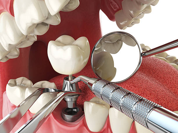 Best Emergency Dentist for Knocked-Out Tooth in Delevan, NY
